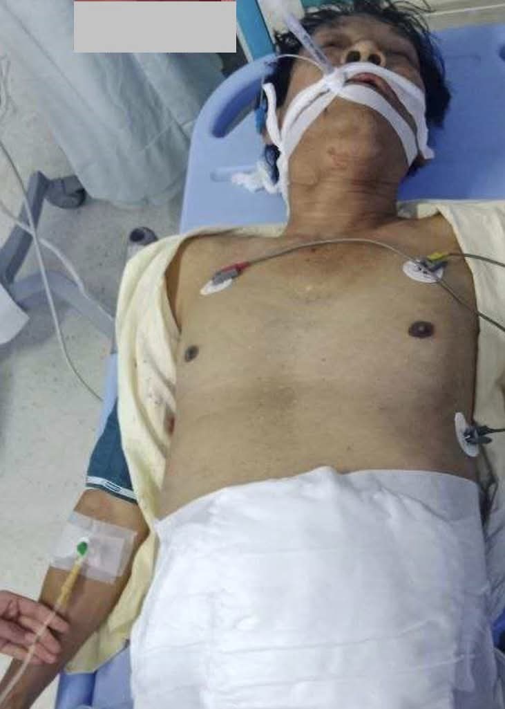 ဟုမ်းလမ်းဘူတာ ရပ်ကွက်အုပ်ချုပ်ရေးမှူး စန်းငွေ ဒဏ်ရာပြင်းထန်၍ ဆေးကုသရင်း သေပြီ