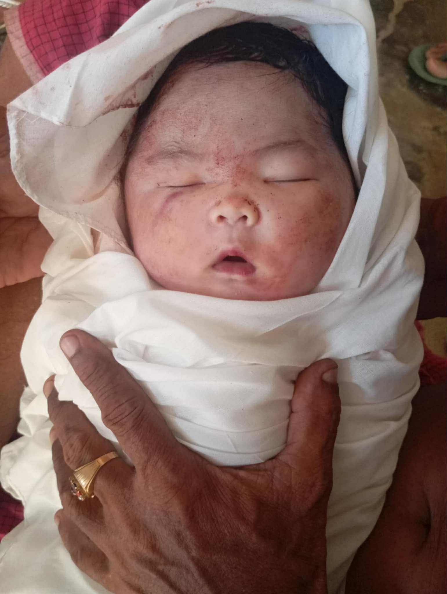 ၁၃ ပေါင်ရှိတဲ့ ကလေးကို ခွဲမမွေးဘဲ ရိုးရိုးမွေးခိုင်းတာ…