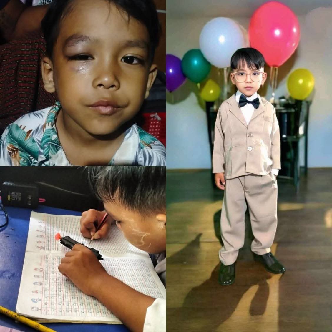 ကလေးမျက်လုံးထိတာကို မိဘကိုအကြောင်းမကြားဘဲ ရေခဲချောင်းဝယ်ကပ်လိုက်ဆိုတဲ့ ဆရာမ