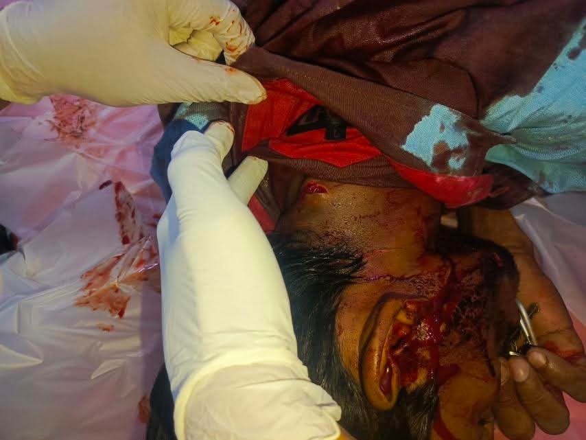 ဂျပန် တံတားပေါ်မှာ အမျိုးသားတယောက်  ဓားနဲ့လေးချက် ထိုးခံရပြီး ဖုန်းနဲ့ ပိုက်ဆံ အလုခံရ