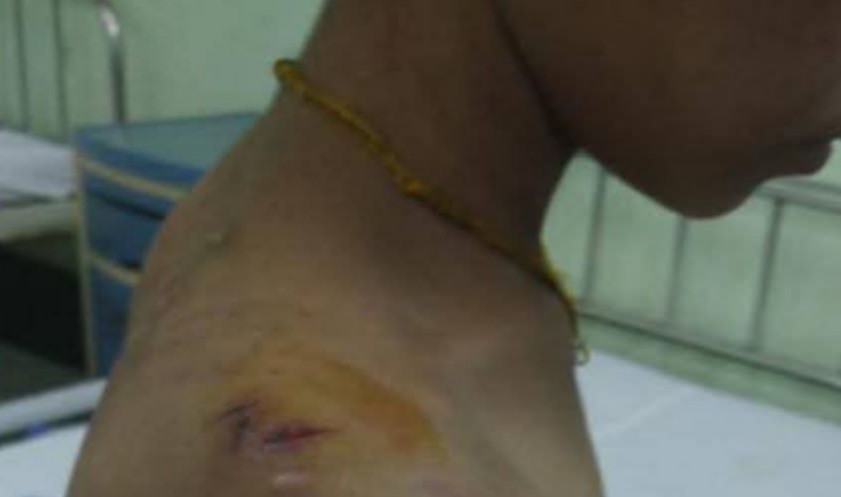 အိမ်ရှင်က ရိုက်နှက်နှိပ်စက်လို့ ထွက်ပြေးလာတဲ့   ၁၁ နှစ်အရွယ် မိန်းကလေး