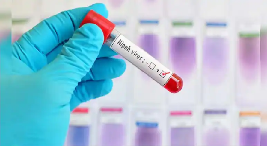 ကာကွယ်ဆေး မရှိ၊ သေဆုံးနှုန်း မြင့်မားသည့် နီပါဗိုင်းရပ်စ်အန္တရာယ်