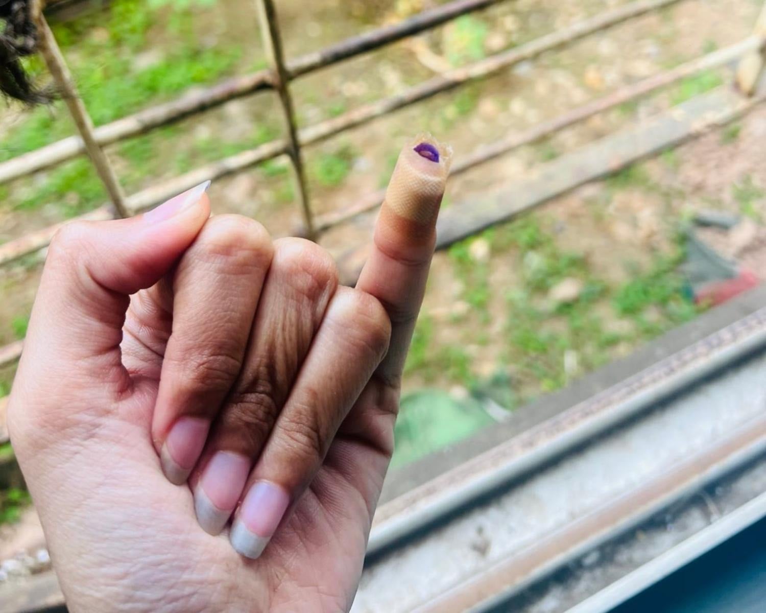 မသတီ၍ ပလာစတာနှင့် အုပ်ထားရသည့် မှင်စွန်းလက်သန်း