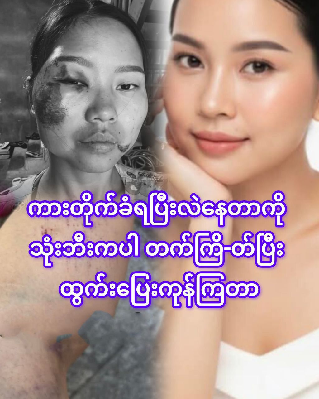 ခုနောက်ပိုင်း ဥပဒေမဲ့လာတော့