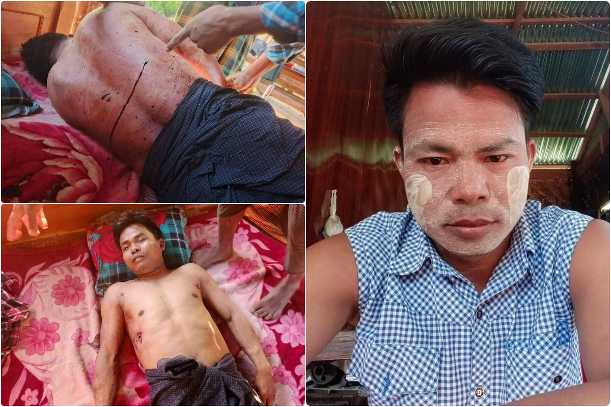 BNRA ရဲဘော် ၂ ယောက်ကပစ်ခတ်လို့ ယင်းမာပင်ခရိုင်တပ်ရင်း ၄ အဖွဲ့ဝင်ကိုကတုံးသေဆုံး