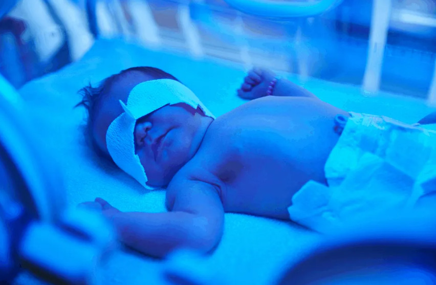 အသားဝါလို့ မီးပြရင်းကနေ အသက်ပြန်မပါလာတော့တဲ့ သားငယ်လေး🥲