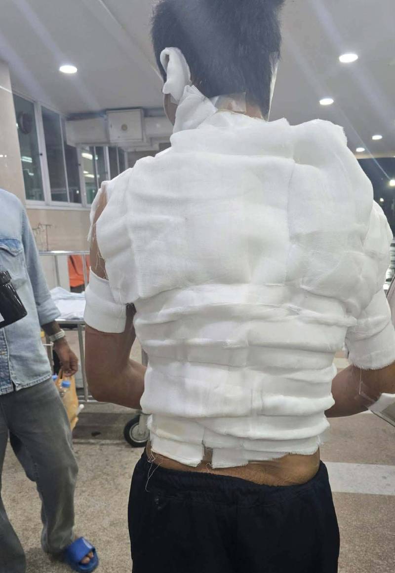 ထိုင်းတွင် မြန်မာလုပ်သားကို ရေနွေးပူနှင့် လောင်းပြီး ရိုက်နှက်နှိပ်စက်ခဲ့သူ ၄ ဦး ဖမ်းမိ၊ ၂ ဦး ထွက်ပြေးနေ